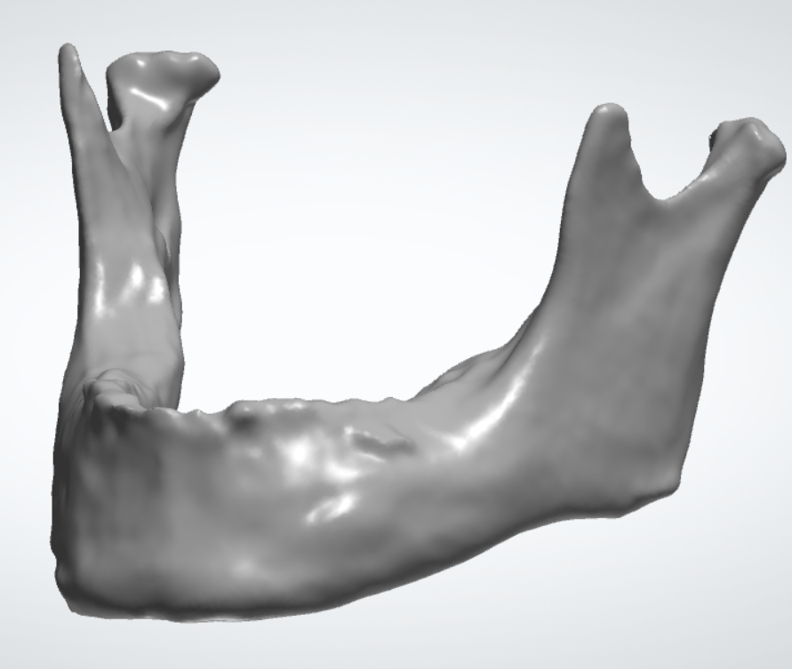 齿科类 3D打印模型