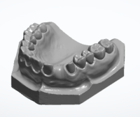 齿科类 3D打印模型