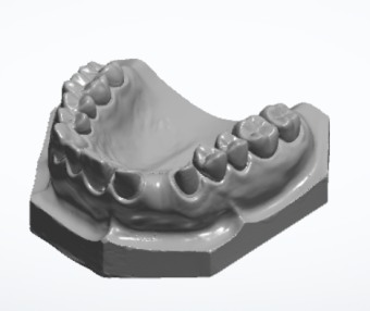 齿科类 3D打印模型
